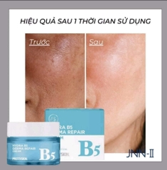 Kem Dưỡng Prettyskin Hydra B5 Derma Repair Cream Dưỡng Trắng, Phục Hồi Da 52ml