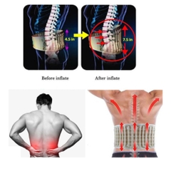 Đai Hơi Điều Chỉnh Cột Sống Giúp Điều Trị Đau Lưng Do Thoát Vị Đĩa Đệm, Đẩy Lùi Thoái Hóa