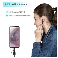 Bộ Ráy Tai Có Camera Nội Soi HD Visual Earpick