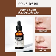 Tinh Chất Dưỡng Trắng Chống Lão Hoá Some By Mi Galactomyces Pure Vitamin C Glow Serum 30ml