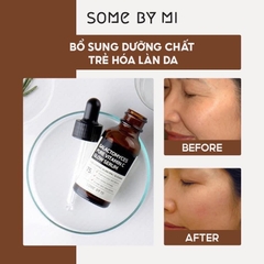 Tinh Chất Dưỡng Trắng Chống Lão Hoá Some By Mi Galactomyces Pure Vitamin C Glow Serum 30ml