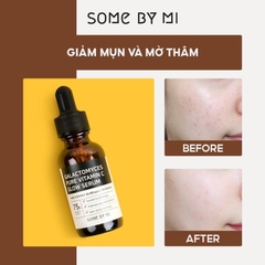 Tinh Chất Dưỡng Trắng Chống Lão Hoá Some By Mi Galactomyces Pure Vitamin C Glow Serum 30ml
