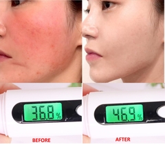 Tinh chất ốc sên đen giảm sẹo lõm - sẹo mụn Some By Mi Snail Truecica Miracle Serum