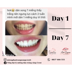 Miếng Dán Trắng Răng Crest 3D White Professional Effects Của Mỹ - Làm Trắng Răng Tại Nhà Tẩy Trắng Răng Cấp Tốc Combo 7 gói