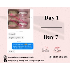 Kem đánh răng Crest Complete Extra Whitening Scope - Phiên bản cải tiến hiệu quả làm trắng răng gấp 35%