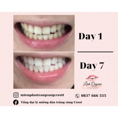 Miếng Dán Trắng Răng Crest 3D White Của Mỹ - Làm Trắng Răng Tại Nhà Tẩy Trắng Răng Cấp Tốc Combo 7 gói
