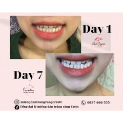 Kem Đánh Răng Crest Baking Soda & Peroxide Whitening Làm Trắng Răng Hiệu Quả