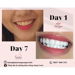 Miếng Dán Trắng Răng Crest 3D White Của Mỹ - Làm Trắng Răng Tại Nhà Tẩy Trắng Răng Cấp Tốc Combo 7 gói