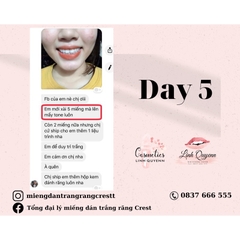 Kem đánh răng Crest Complete Extra Whitening Scope - Phiên bản cải tiến hiệu quả làm trắng răng gấp 35%