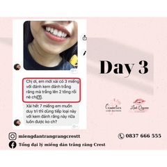 Kem đánh răng Crest Complete Extra Whitening Scope - Phiên bản cải tiến hiệu quả làm trắng răng gấp 35%