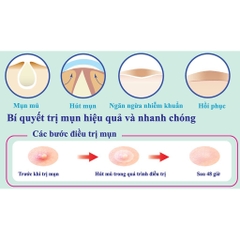 Miếng Dán Mụn Mayan Care Ultra Thin Spot Hàn Quốc Hiệu Quả Trong 48H (12 Miếng - 20 Miếng)