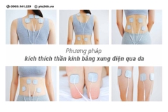 Kích thích thần kinh dưới da bằng xung điện (TENS) là gì?