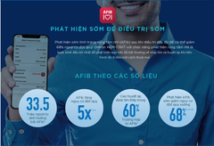 Máy Đo Huyết Áp HEM7361T