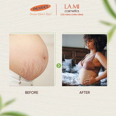 Kem ngăn ngừa và giảm vết rạn Palmer's Massage cream 125g