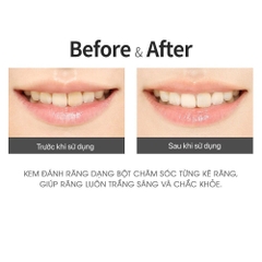 Bột Đánh Trắng Răng Giảm Hôi Miệng Bring Tooth Powder So Natural Hàn Quốc