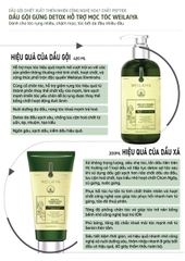 Bộ Dầu Gội Xả Gừng Hỗ Trợ Mọc Tóc Detox Da Đầu 420ml + 200ml