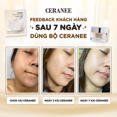 Bộ Dưỡng Da Combo Mặt Nạ + Kem Dưỡng Da Ceranee