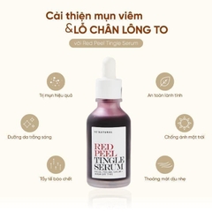 Tinh chất tẩy tế bào chết hóa học Redpeel Tingel Serum So Natural 35ml