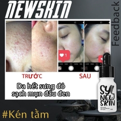 Serum Trị Mụn Kén Tằm NewSkin Sylic Phiên Bản Mới Lọ 10ml