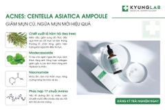 Serum Trị Mụn Kyung Lab Acnes Centella Asiatica Ampoule 50ml