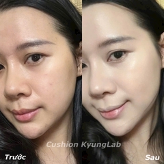 Cushion Kyunglab Mẫu Mới