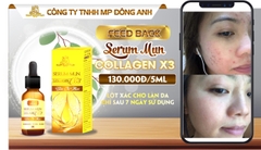 Serum Đặc Trị Mụn