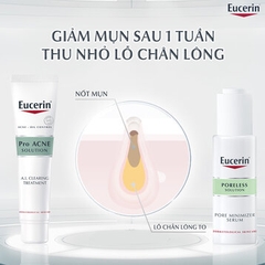 Tinh Chất Eucerin Giảm Mụn Viêm và Không Viêm 40ml