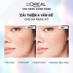 Serum LOreal Paris Dưỡng Sáng Và Mờ Thâm Nám 30ml