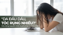 Da Đầu Nhanh Bết, Tóc Rụng Càng Nhiều? Hiểu Đúng Nguyên Nhân & Giải Pháp Từ Thiên Nhiên