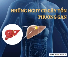 NHỮNG NGUY CƠ GÂY TỔN THƯƠNG GAN