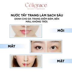 Nước Tẩy Trang L'OREAL Dưỡng Ẩm Cho Da Thường, Khô Micellar Water 3-in-1 Moisturizing Even For Sensitive Skin (Nắp Hồng)