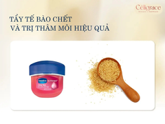 Sáp Dưỡng Môi Vaseline Cấp Ẩm, Mềm Mịn, Chống Khô Và Nứt Nẻ Lip Therapy 7g