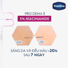 Sữa Dưỡng Thể Vaseline Cấp Ẩm, Dưỡng Da Sáng Mịn Vaseline Pro Derma 250ml