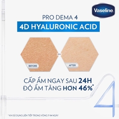 Sữa Dưỡng Thể Vaseline Cấp Ẩm, Dưỡng Da Sáng Mịn Vaseline Pro Derma 250ml