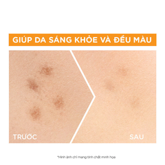 Serum Garnier Tinh Chất Tăng Cường Sáng Da Mờ Thâm GARNIER Light Complete Vitamin C 30X Booster Serum 30ml