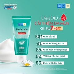 Kem Rửa Mặt Hada Labo Cho Da Mụn Và Nhạy Cảm Acne Care Calming Cleanser 80g