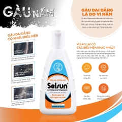 Dầu Gội Selsun Ngăn Ngừa Gàu & Nấm, Hỗ Trợ Giảm Ngứa Da Đầu Anti-Dandruff Shampoo