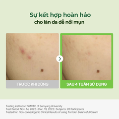 Kem Dưỡng TORRIDEN Làm Dịu, Phục Hồi Da Bị Tổn Thương Balanceful Cica Cream 80ml