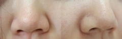 Miếng Dán Hút Mụn Đầu Đen, Sợi Bã Nhờn Ciracle Blackhead Cotton Mask 5ml