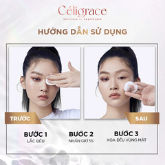 Nước Tẩy Trang L'OREAL Làm Sạch Sâu Trang Điểm Micellar Water 3-in-1 Deep Cleansing Even For Sensitive Skin (Nắp Xanh Đậm)