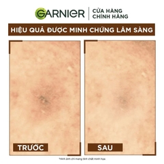 Serum Garnier Tinh Chất Dưỡng Sáng Da, Mờ Thâm Ban Đêm 10% Vitamin C - Bright Complete Overnight Serum 30ml