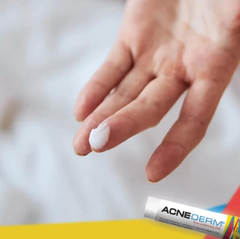 Kem Trị Mụn, Mờ Thâm Acne-Derm Kwas Azelainowy 20% 20g