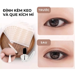 Dán Mí Lưới Keli Allergy Eyelid Sticker (60 Miếng)
