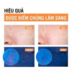 Sữa Rửa Mặt Neutrogena Làm Sạch Sâu Dạng Gel Deep Clean Facial Gel Cleanser 150ml