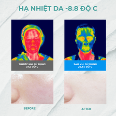 Mặt Nạ Đất Sét Aperire Băng Lạnh Thu Nhỏ Lỗ Chân Lông Và Điều Tiết Dầu Thừa Spa Relief Be Frozen Pore Mask 120g (XANH)