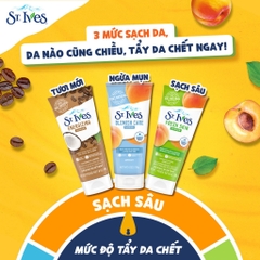 Sữa Rửa Mặt Có Hạt ST.IVES Tẩy Da Chết Chiết Xuất Thiên Nhiên