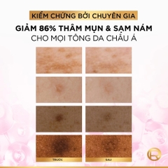 [Mới] Serum L'oreal Tinh Chất Mờ Thâm Nám Glycolic-Bright Melasyl 8% [Melasyl+Glycolic+Niacinamide]