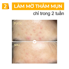Tinh Chất Numbuzin Hỗ Trợ Dưỡng Trắng Sáng Da Và Làm Mờ Thâm Nám No.5+ Vitamin Concentrated Serum 30ml