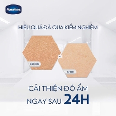 Sữa Dưỡng Thể Vaseline Cấp Ẩm, Dưỡng Da Sáng Mịn Vaseline Pro Derma 250ml
