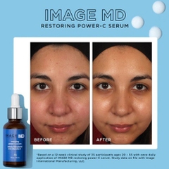 [CLESAL2401 - DATE 06/2024] Serum IMAGE Làm Sáng, Giảm Nếp Nhăn MD Restoring Power-C 30ml